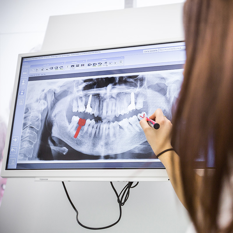 A woman pointing at a red dot on an X-ray image displayed on a monitor.