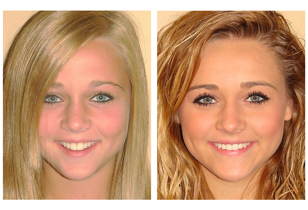 Frisco Smiles Dentistry