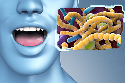 The image shows a 3D rendering of a human mouth with an open mouth, displaying teeth, and a visible tongue, with a graphic overlay featuring a microscopic view of bacteria-like cells that resemble a bacterial colony.