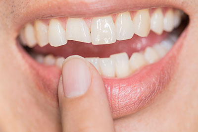 A person s hand holding a toothbrush near an open mouth with yellow teeth, showing a close-up of dental hygiene.