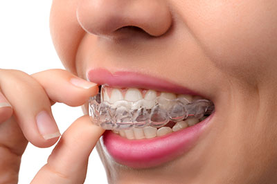 Woman with braces holding her teeth together.