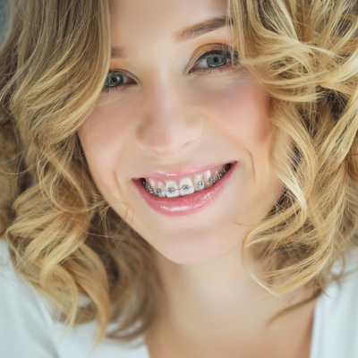A woman with straightened teeth is smiling at the camera, showcasing her braces, against a white background.