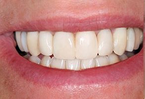 Frisco Smiles Dentistry | Oral Cancer Screening, Emergency Treatment and Cosmetic Dentistry